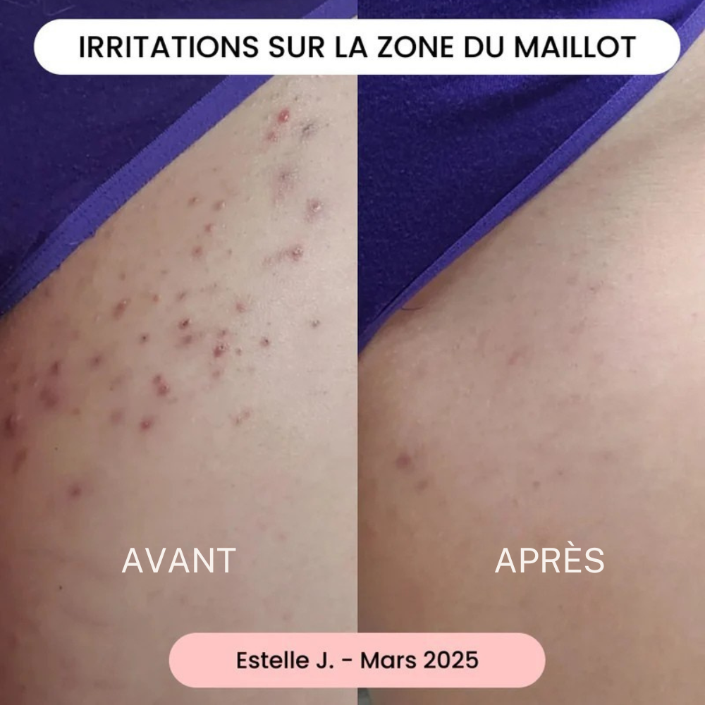 LumiSkin – Mousse dépilatoire