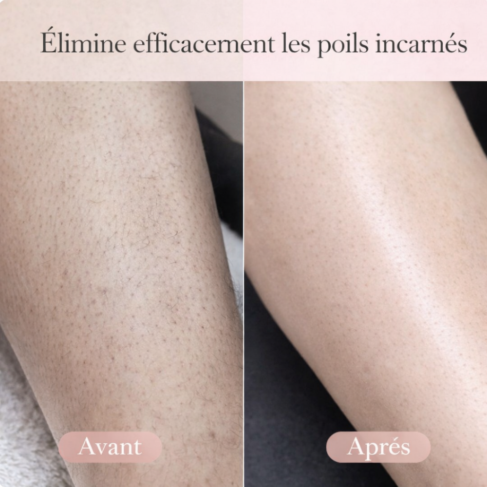 LadySkin – Tondeuse Intime