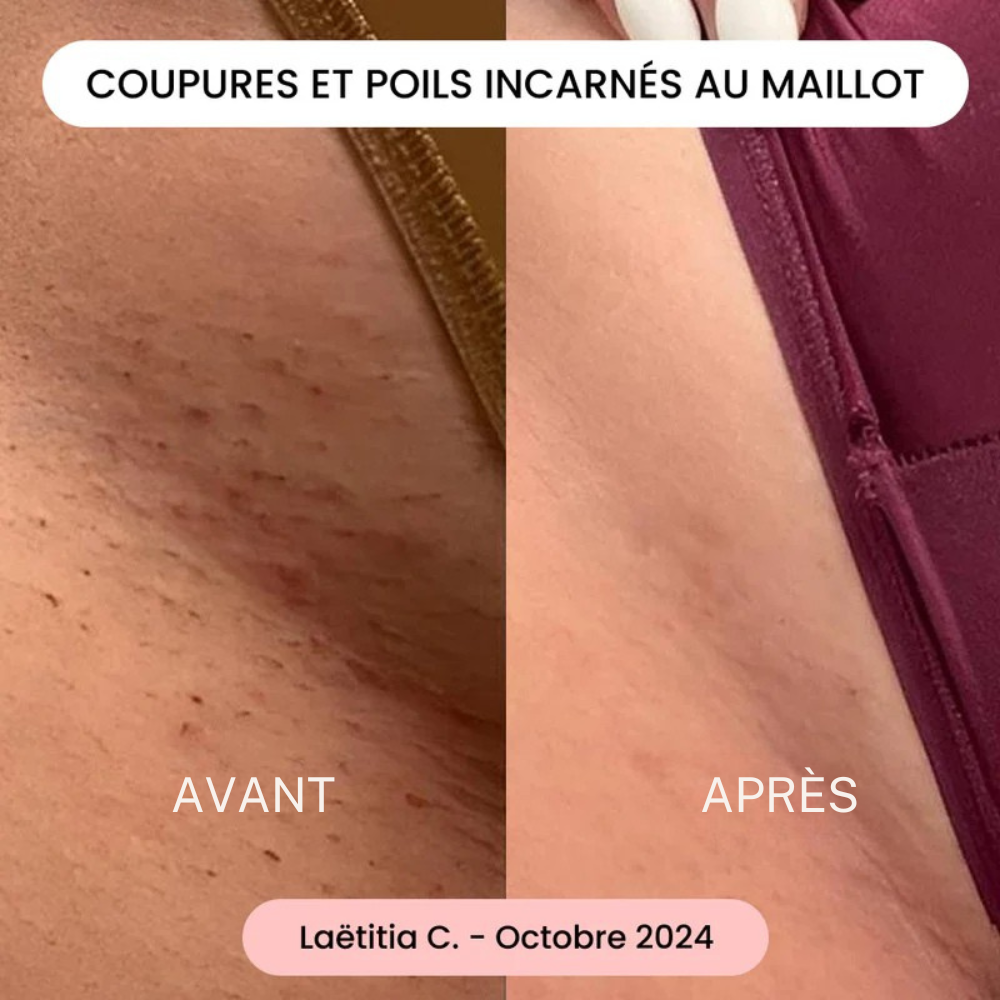 LumiSkin – Mousse dépilatoire