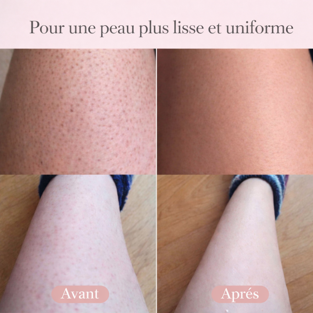 LadySkin – Tondeuse Intime
